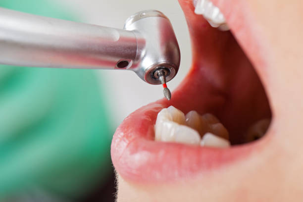Best Weekend Emergency Dental Services in Riva, MD